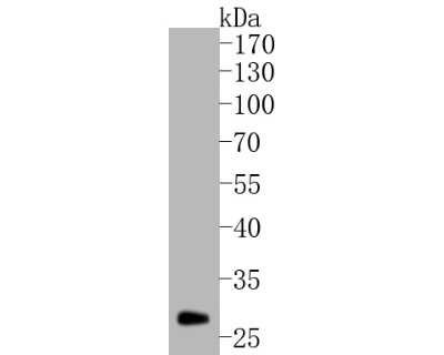 Western Blot: Mcl-1 Antibody (SI16-04) [NBP2-67400]