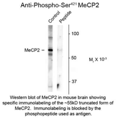 Western Blot: MeCP2 [p Ser421] Antibody [NBP2-29524]