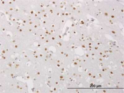 Immunohistochemistry-Paraffin: MeCP2 Antibody (1B11) [H00004204-M03]