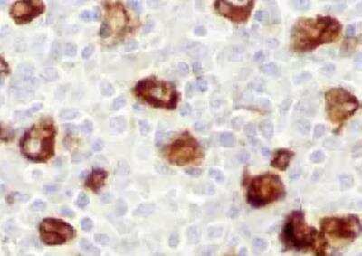 Immunohistochemistry-Paraffin: MeCP2 Antibody (1B11) [H00004204-M03]