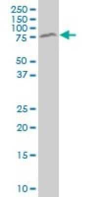 Western Blot: MeCP2 Antibody (1B11) [H00004204-M03]