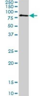 Western Blot: MeCP2 Antibody (1B11) [H00004204-M03]