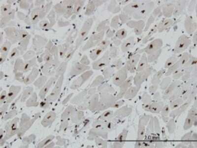 Immunohistochemistry-Paraffin: MeCP2 Antibody (4B6) [H00004204-M01]