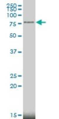 Western Blot: MeCP2 Antibody (4B6) [H00004204-M01]