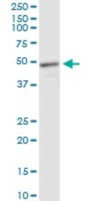Western Blot: MeCP2 Antibody (4B6) [H00004204-M01]
