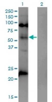 Western Blot: MeCP2 Antibody (4B6) [H00004204-M01]