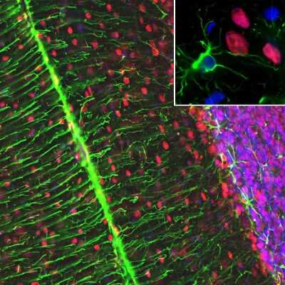 Immunocytochemistry/ Immunofluorescence: MeCP2 Antibody (5H12) [NBP2-60787]