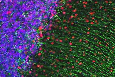 Immunocytochemistry/ Immunofluorescence: MeCP2 Antibody (5H12) [NBP2-60787]