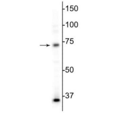 Western Blot: MeCP2 Antibody (5H12) [NBP2-60787]