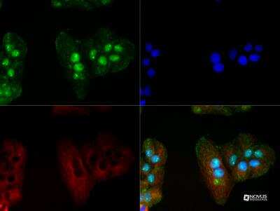 Immunocytochemistry/ Immunofluorescence: MeCP2 Antibody [NB100-56326]