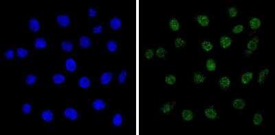 Immunocytochemistry/ Immunofluorescence: MeCP2 Antibody [NB600-1101]