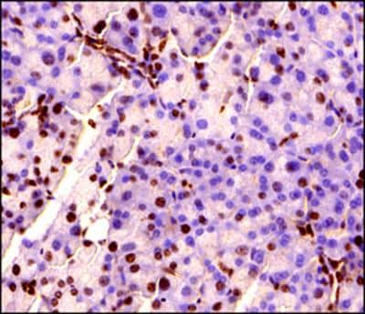 Immunohistochemistry-Paraffin: MeCP2 Antibody [NB100-56326]