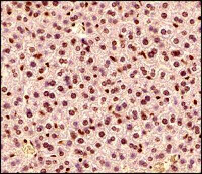 Immunohistochemistry-Paraffin: MeCP2 Antibody [NB100-56326]