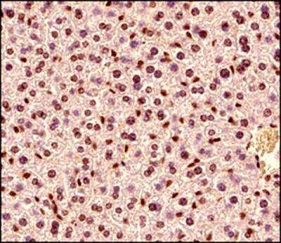 Immunohistochemistry-Paraffin: MeCP2 Antibody [NB100-56326]