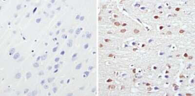 Immunohistochemistry-Paraffin: MeCP2 Antibody [NB600-1101]