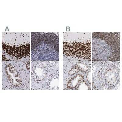 Immunohistochemistry-Paraffin: MeCP2 Antibody [NBP1-81027]