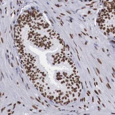 Immunohistochemistry-Paraffin: MeCP2 Antibody [NBP1-81027]