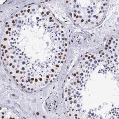 Immunohistochemistry-Paraffin: MeCP2 Antibody [NBP1-81027]