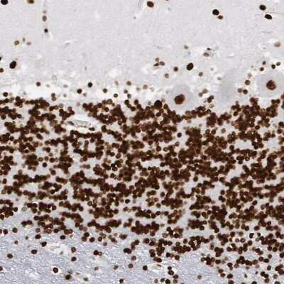 Immunohistochemistry-Paraffin: MeCP2 Antibody [NBP1-81028]
