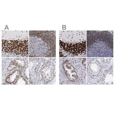 Immunohistochemistry-Paraffin: MeCP2 Antibody [NBP1-81028]