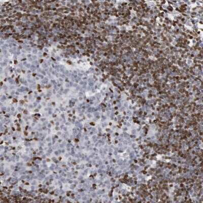Immunohistochemistry-Paraffin: MeCP2 Antibody [NBP1-81028]