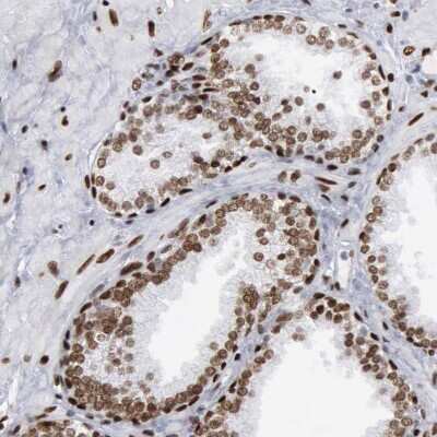 Immunohistochemistry-Paraffin: MeCP2 Antibody [NBP1-81028]