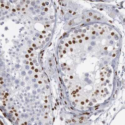 Immunohistochemistry-Paraffin: MeCP2 Antibody [NBP1-81028]