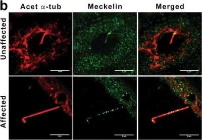 Immunohistochemistry: Meckelin Antibody [NBP1-06590]