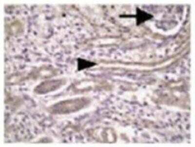 Immunohistochemistry-Paraffin: Meckelin Antibody [NBP1-06590]