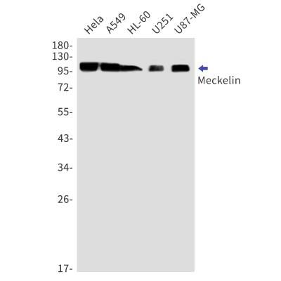 Western Blot: Meckelin Antibody (S07-2A4) [NBP3-19888]