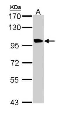 Western Blot: Meckelin Antibody [NBP1-32896]