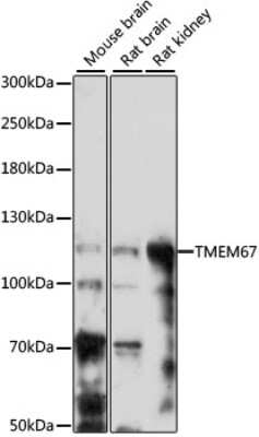 Western Blot: Meckelin AntibodyAzide and BSA Free [NBP3-03802]