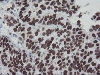 Immunohistochemistry-Paraffin: Meis homeobox 3 Antibody (OTI3E12) [NBP2-03933]