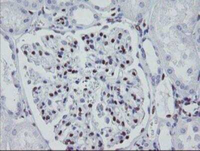 Immunohistochemistry-Paraffin: Meis homeobox 3 Antibody (OTI3E12) [NBP2-03933]