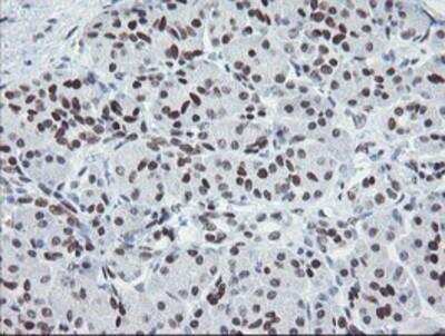 Immunohistochemistry-Paraffin: Meis homeobox 3 Antibody (OTI3E12) [NBP2-03933]