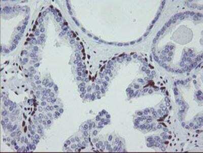 Immunohistochemistry-Paraffin: Meis homeobox 3 Antibody (OTI3E12) [NBP2-03933]