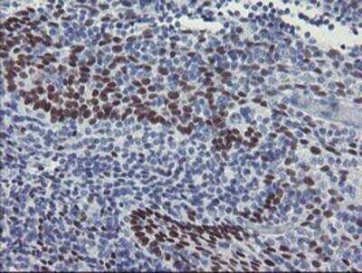 Immunohistochemistry-Paraffin: Meis homeobox 3 Antibody (OTI3E12) [NBP2-03933]