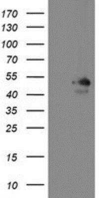 Western Blot: Meis homeobox 3 Antibody (OTI3E12) [NBP2-03933]