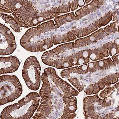 Immunohistochemistry-Paraffin: Meis homeobox 3 Antibody [NBP2-14230]