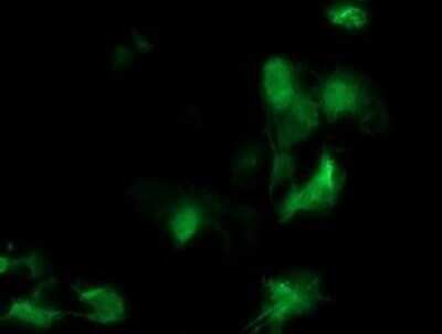 Immunocytochemistry/ Immunofluorescence: Meis homeobox 3 Antibody (OTI3A7) - Azide and BSA Free [NBP2-72641]