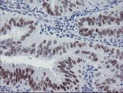 Immunohistochemistry: Meis homeobox 3 Antibody (OTI3E12) - Azide and BSA Free [NBP2-72642]