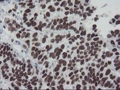 Immunohistochemistry: Meis homeobox 3 Antibody (OTI3E12) - Azide and BSA Free [NBP2-72642]