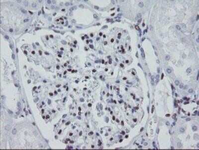 Immunohistochemistry: Meis homeobox 3 Antibody (OTI3E12) - Azide and BSA Free [NBP2-72642]