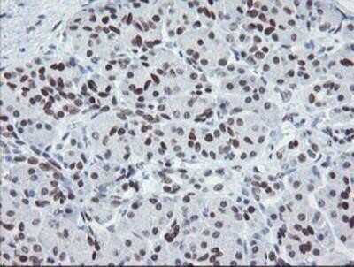 Immunohistochemistry: Meis homeobox 3 Antibody (OTI3E12) - Azide and BSA Free [NBP2-72642]