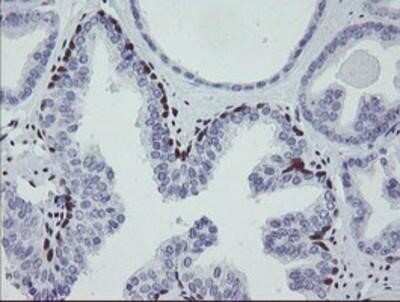Immunohistochemistry: Meis homeobox 3 Antibody (OTI3E12) - Azide and BSA Free [NBP2-72642]