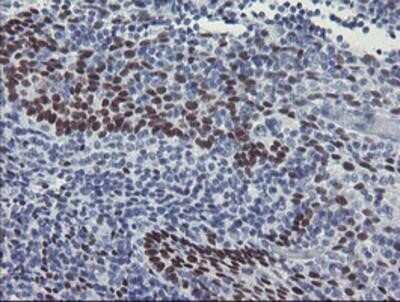 Immunohistochemistry: Meis homeobox 3 Antibody (OTI3E12) - Azide and BSA Free [NBP2-72642]