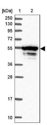 Western Blot: Meis homeobox 3 Antibody [NBP2-14230]