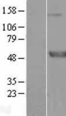 Western Blot: Meis homeobox 3 Overexpression Lysate [NBL1-13005]