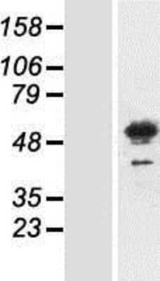 Western Blot: Meis homeobox 3 Overexpression Lysate [NBP2-11178]