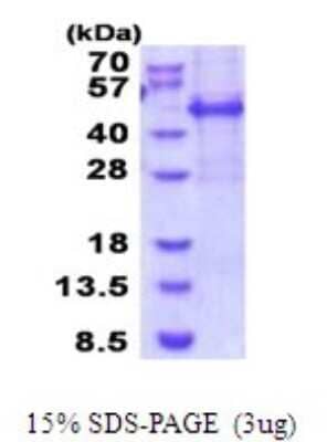 SDS-PAGE: Recombinant Human Meis homeobox 3 His Protein [NBP2-51883]